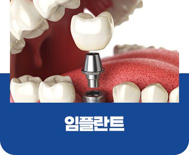 임플란트