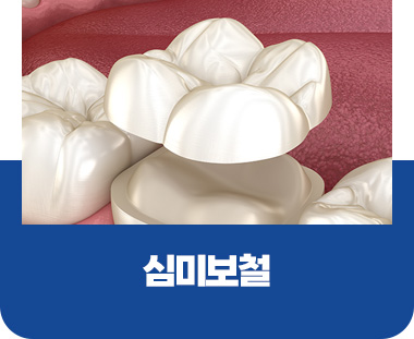 심미보철